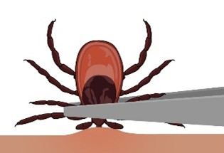 Grasp the tick close to the skin as possible